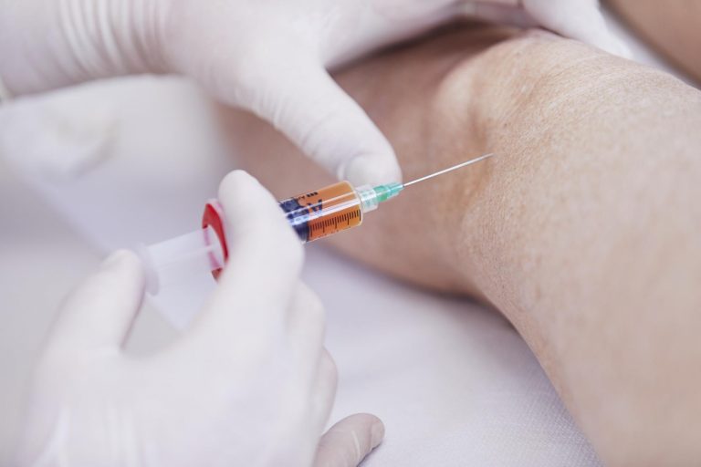 Wie Lange Dauert Es Bis Sich Eine Bakerzyste Zurückbildet Bakerzyste » Ordination Url | Orthopäde Dr. Robert Url in Graz