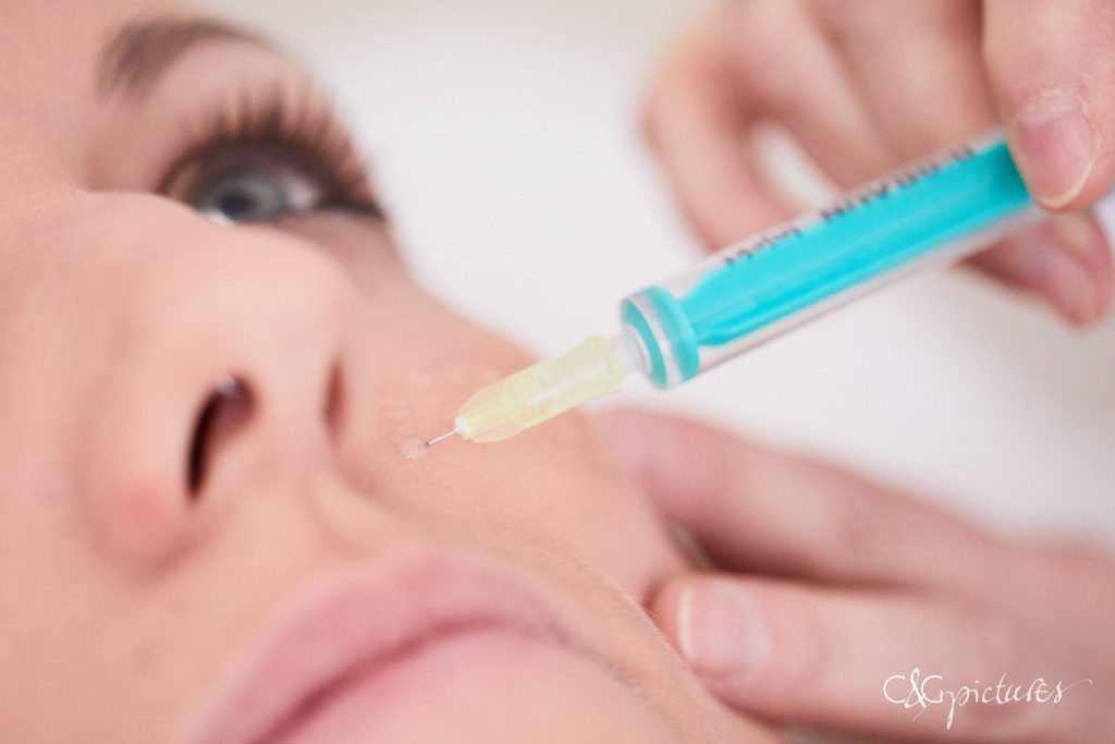 Mesotherapie - Ordination Dr Url