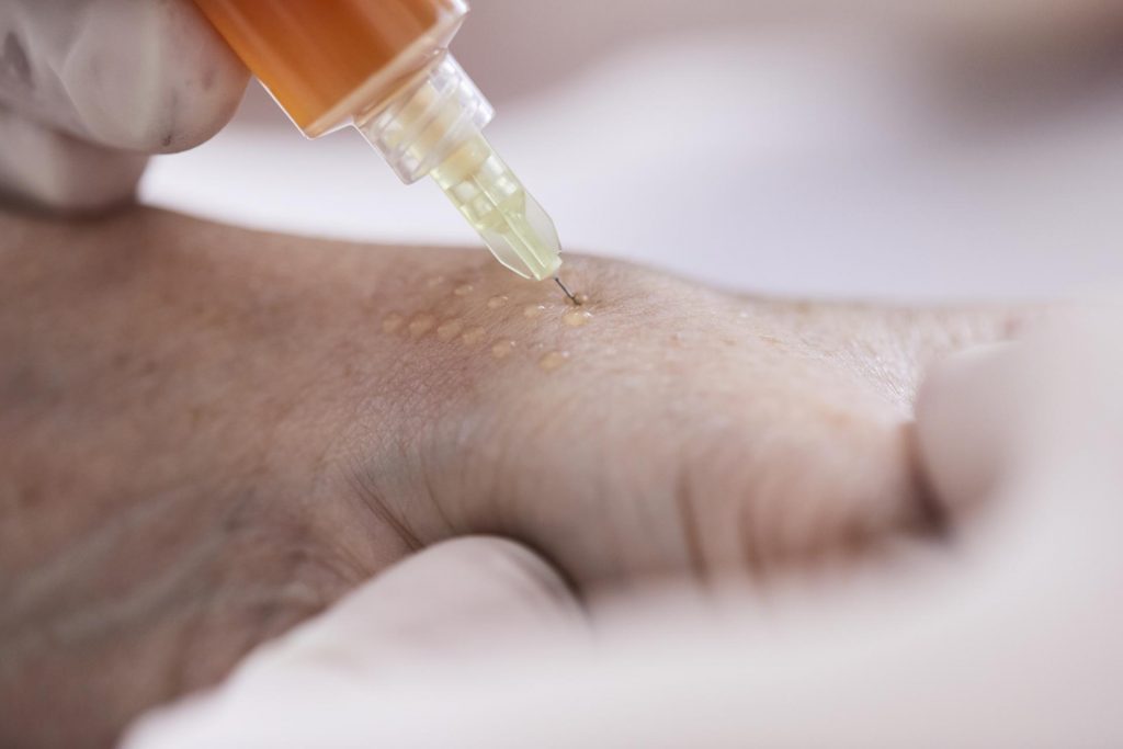 Mesotherapie - Ordination Dr. Url