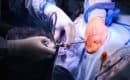 Operative Behandlung Kalkschulter - Ordination Dr. Url