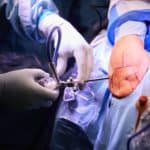 Operative Behandlung Kalkschulter - Ordination Dr. Url